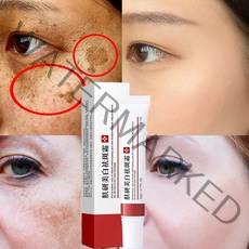 화이트닝 주근깨 크림 기미 크림 제거 다크 스팟 제거 멜라닌 기미 리무버 브라이트닝 스킨 안티 에이징 스킨 라이트닝, 하나, 하나