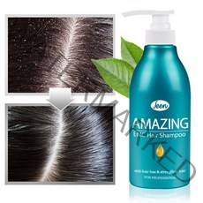 어메이징 EMC 약산성샴푸 비듬 두피 각질 지성 단백질 샴푸 500ml, 1개