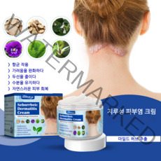 SOUTH MOON 지루성 두피염 탈모 머리 여드름이 가렵다 두피진균 여드름 케어 피부 연고