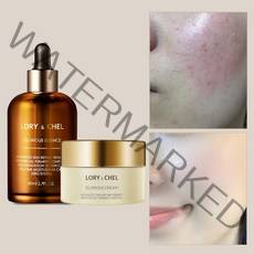 로리앤첼 글로리어스 수분 보습 크림 & 에센스 세트, 글로리어스 크림 에센스 세트, 1세트