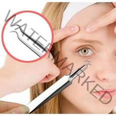 블랙헤드 압출기 핀셋 피지 쥐젖 갈고리형, 1개